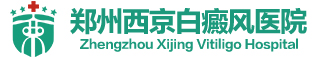 许昌白癜风医院