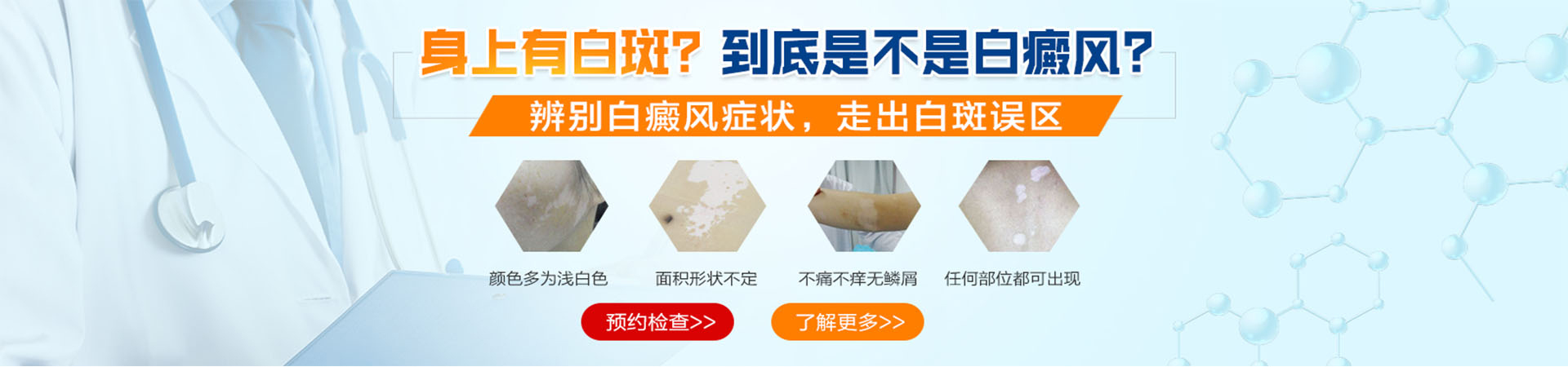 许昌白癜风医院简介